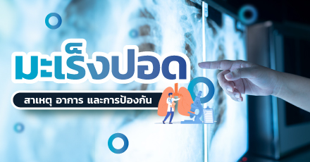 รู้จักกับมะเร็งปอด สาเหตุ อาการ และการป้องกัน